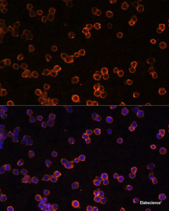 Immunofluorescence analysis of Raw264.7 cells using ENTPD1/CD39 Polyclonal Antibody at dilution of 1:100 (40x lens) . Blue: DAPI for nuclear staining.