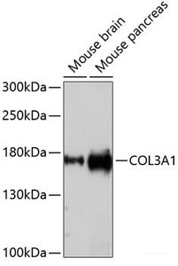 Western blot analysis of extracts of various cell lines using COL3A1 Polyclonal Antibody at dilution of 1:1000.