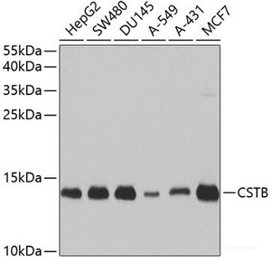 Western blot analysis of extracts of various cell lines using CSTB Polyclonal Antibody at dilution of 1:1000.