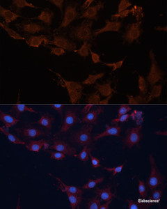 Immunofluorescence analysis of C6 cells using HMGCS1 Polyclonal Antibody at dilution of 1:100 (40x lens) . Blue: DAPI for nuclear staining.