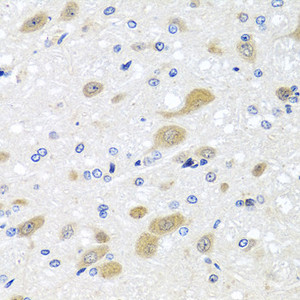 Immunohistochemistry of paraffin-embedded Rat brain using LCAT Polyclonal Antibody at dilution of 1:100 (40x lens) .