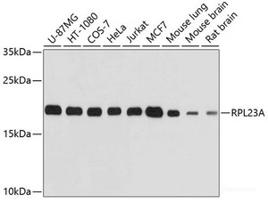 Western blot analysis of extracts of various cell lines using RPL23A Polyclonal Antibody at dilution of 1:1000.