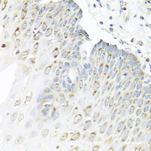 Immunohistochemistry of paraffin-embedded Human esophagus using STAU1 Polyclonal Antibody at dilution of 1:100 (40x lens) .