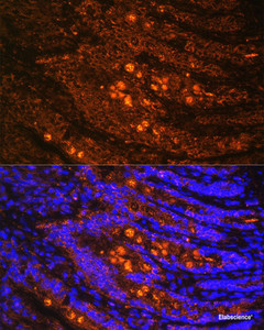 Immunofluorescence analysis of Rat Intestine using TLN1 Polyclonal Antibody at dilution of 1:100. Blue: DAPI for nuclear staining.