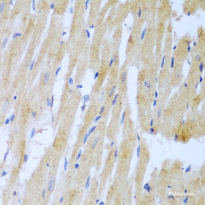 Immunohistochemistry of paraffin-embedded Rat heart using UBE2L3 Polyclonal Antibody at dilution of 1:100 (40x lens) .