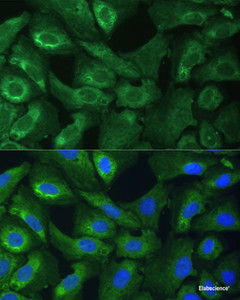 Immunofluorescence analysis of U-2 OS cells using EIF3G Polyclonal Antibody at dilution of 1:100 (40x lens) . Blue: DAPI for nuclear staining.