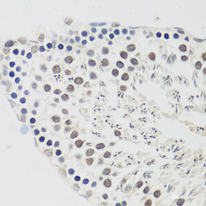 Immunohistochemistry of paraffin-embedded Rat testis using CCNE2 Polyclonal Antibody at dilution of 1:100 (40x lens) .