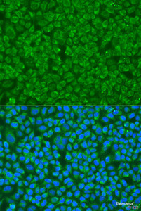 Immunofluorescence analysis of U2OS cells using GOSR1 Polyclonal Antibody at dilution of 1:100. Blue: DAPI for nuclear staining.