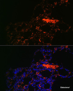 Immunofluorescence analysis of Rat lung using ABCG1 Polyclonal Antibody at dilution of 1:100. Blue: DAPI for nuclear staining.