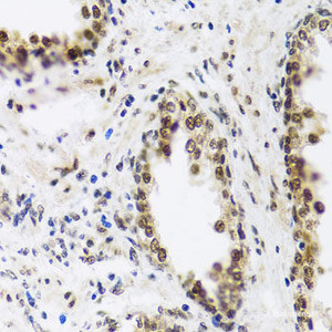 Immunohistochemistry of paraffin-embedded Human prostate using SAFB2 Polyclonal Antibody at dilution of 1:100 (40x lens) .
