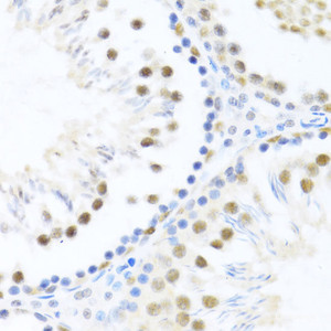 Immunohistochemistry of paraffin-embedded Rat testis using DDX46 Polyclonal Antibody at dilution of 1:100 (40x lens) .