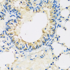 Immunohistochemistry of paraffin-embedded Mouse lung using ABCF2 Polyclonal Antibody at dilution of 1:100 (40x lens) .