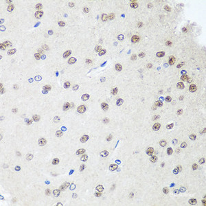 Immunohistochemistry of paraffin-embedded Rat brain using SAP18 Polyclonal Antibody at dilution of 1:100 (40x lens) .