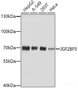 Western blot analysis of extracts of various cell lines using IGF2BP3 Polyclonal Antibody at dilution of 1:1000.