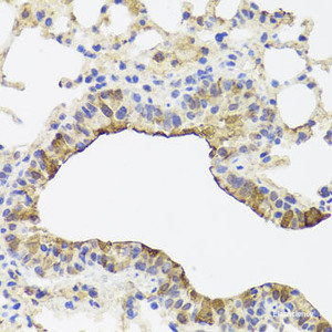 Immunohistochemistry of paraffin-embedded Mouse lung using TOMM34 Polyclonal Antibody at dilution of 1:100 (40x lens) .