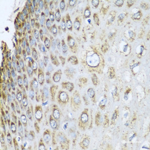 Immunohistochemistry of paraffin-embedded Human esophagus using PHB2 Polyclonal Antibody at dilution of 1:100 (40x lens) .