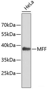 Western blot analysis of extracts of HeLa cells using MFF Polyclonal Antibody.