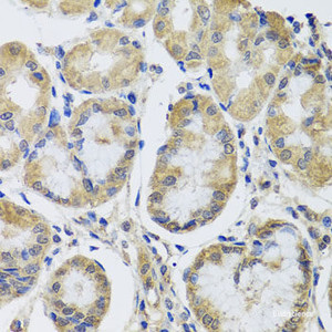 Immunohistochemistry of paraffin-embedded Human stomach using MRPL1 Polyclonal Antibody at dilution of 1:100 (40x lens) .