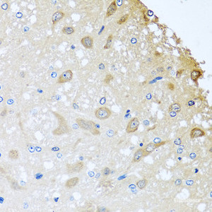 Immunohistochemistry of paraffin-embedded Rat brain using COLEC11 Polyclonal Antibody at dilution of 1:100 (40x lens) .