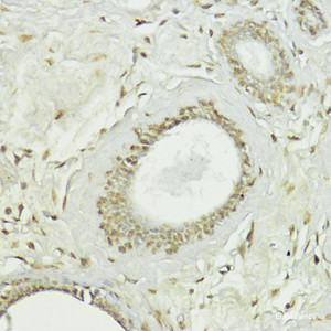 Immunohistochemistry of paraffin-embedded Human breast using Snail Polyclonal Antibody at dilution of 1:100 (40x lens) .