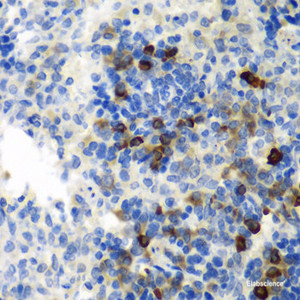 Immunohistochemistry of paraffin-embedded Rat spleen using AIMP1 Polyclonal Antibody at dilution of 1:100 (40x lens) .