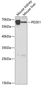 Western blot analysis of extracts of various cell lines using PDZK1 Polyclonal Antibody at dilution of 1:1000.