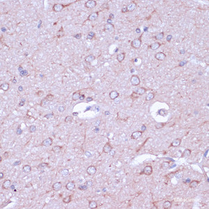 Immunohistochemistry of paraffin-embedded Rat brain using PRKACB Polyclonal Antibody at dilution of 1:100 (40x lens) .