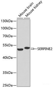 Western blot analysis of extracts of various cell lines using SERPINE2 Polyclonal Antibody at dilution of 1:1000.