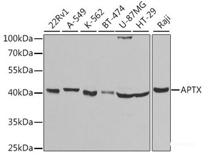 Western blot analysis of extracts of various cell lines using APTX Polyclonal Antibody at dilution of 1:1000.
