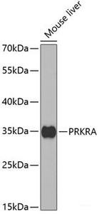 Western blot analysis of extracts of Mouse liver using PRKRA Polyclonal Antibody at dilution of 1:1000.