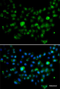 Immunofluorescence analysis of A549 cells using MCM10 Polyclonal Antibody