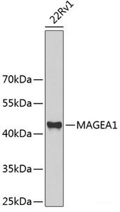 Western blot analysis of extracts of 22Rv1 cells using MAGEA1 Polyclonal Antibody at dilution of 1:1000.