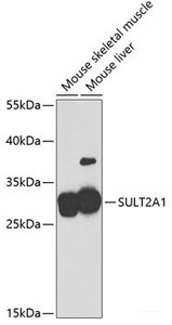 Western blot analysis of extracts of various cell lines using SULT2A1 Polyclonal Antibody at dilution of 1:2000.