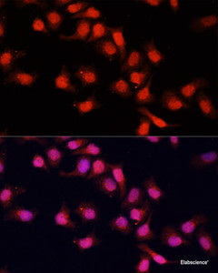 Immunofluorescence analysis of HeLa cells using PRDM14 Polyclonal Antibody at dilution of 1:100. Blue: DAPI for nuclear staining.
