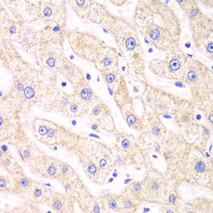 Immunohistochemistry of paraffin-embedded Human liver damage using PSMF1 Polyclonal Antibody at dilution of 1:100 (40x lens) .
