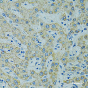 Immunohistochemistry of paraffin-embedded Human liver using STX1A Polyclonal Antibody at dilution of 1:100 (40x lens) .