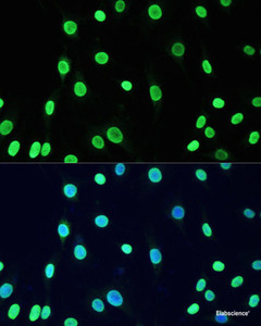 Immunofluorescence analysis of C6 cells using Acetyl-DNMT1-K1127/K1129/K1131/K1133 Polyclonal Antibody at dilution of 1:100. Blue: DAPI for nuclear staining.