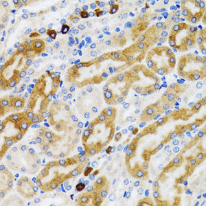 Immunohistochemistry of paraffin-embedded Rat kidney using PGRMC1 Polyclonal Antibody at dilution of 1:100 (40x lens) .