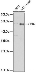 Western blot analysis of extracts of various cell lines using CPB2 Polyclonal Antibody at dilution of 1:1000.