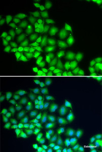 Immunofluorescence analysis of HeLa cells using ERCC2 Polyclonal Antibody