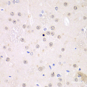 Immunohistochemistry of paraffin-embedded Rat brain using FMR1 Polyclonal Antibody at dilution of 1:100 (40x lens) .