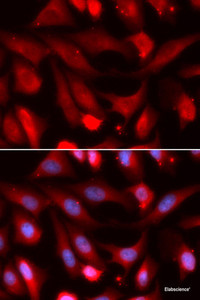 Immunofluorescence analysis of U2OS cells using SMAD4 Polyclonal Antibody