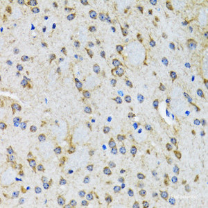 Immunohistochemistry of paraffin-embedded Rat brain using HTR2B Polyclonal Antibody at dilution of 1:100 (40x lens) .