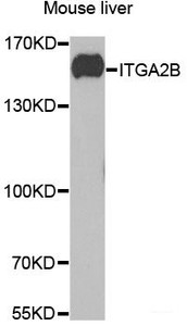 Western blot analysis of extracts of Mouse liver using ITGA2B Polyclonal Antibody at dilution of 1:1000.