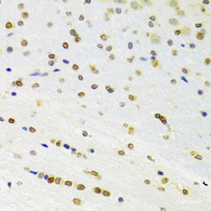 Immunohistochemistry of paraffin-embedded Rat brain using DOK1 Polyclonal Antibody at dilution of 1:100 (40x lens) .