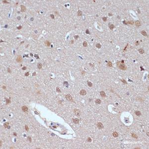 Immunohistochemistry of paraffin-embedded Rat brain using TP53BP2 Polyclonal Antibody at dilution of 1:100 (40x lens) .