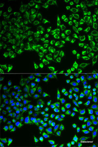 Immunofluorescence analysis of MCF-7 cells using CS Polyclonal Antibody