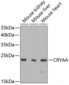 Western blot analysis of extracts of various cell lines using CRYAA Polyclonal Antibody at dilution of 1:1000.