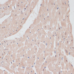 Immunohistochemistry of paraffin-embedded Rat heart using PRPF31 Polyclonal Antibody at dilution of 1:100 (40x lens) .