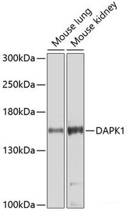 Western blot analysis of extracts of various cell lines using DAPK1 Polyclonal Antibody at dilution of 1:1000.